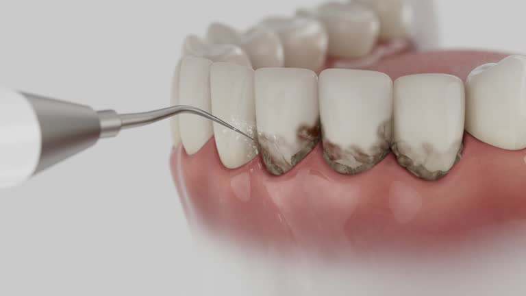 Reliable Dental Implants contractor in Bealeton, VA by Smile Center Dentistry